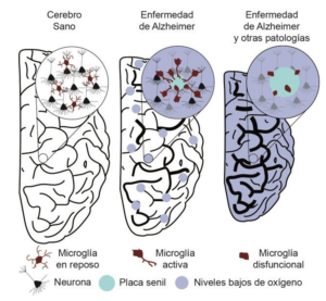 El estudio, desarrollado desde el Instituto de Biomedicina de Sevilla, demuestra que la reducción local de los niveles de oxígeno hace que el cerebro resista peor el avance de la enfermedad.